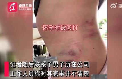 关于家庭暴力，你们怎么看？欢迎大家共同提出案例为广大女性提供帮助女子遭丈夫家暴失明视频怎样摆脱家暴的渣男